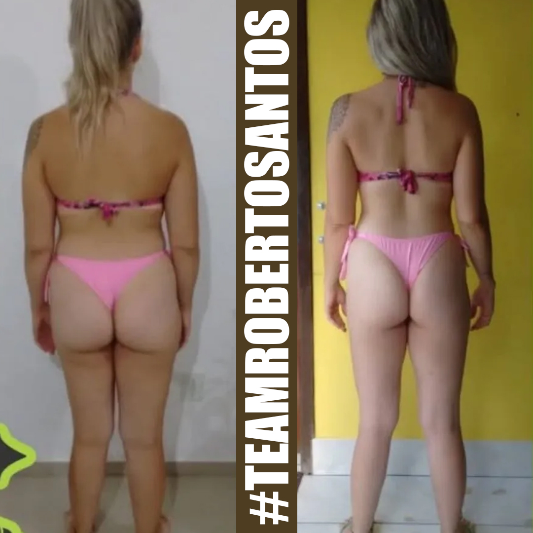 ANTES E DEPOIS ROBERTO SANTOSPrancheta 3